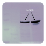 پروتئین نوترکیب (20microgram)La/SSB Human کارمانیا پارس ژن
