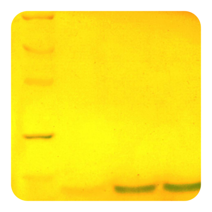 پروتئین نوترکیب (۱۰۰microgram) Smith Ag-۱ کارمانیا پارس ژن