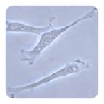 بالغ چسبیده