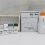 کیت اندازه گیری فعالیت آرژیناز (Arginase)